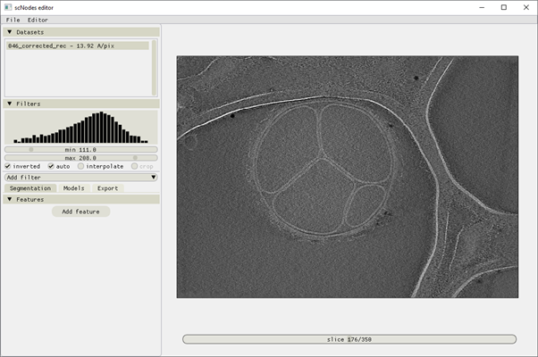 The user interface upon starting the software and importing a single tomogram
