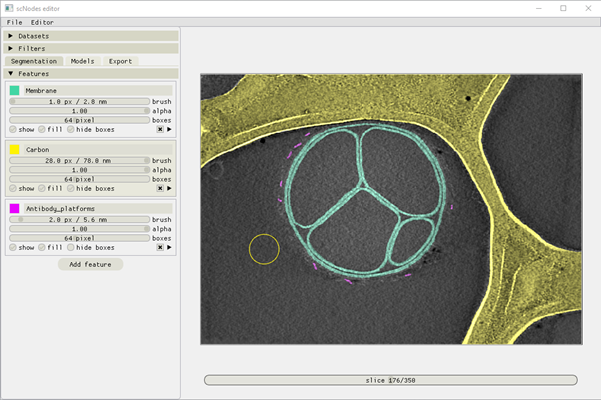 The user interface in the Segmentation stage, with three features set up and annotated