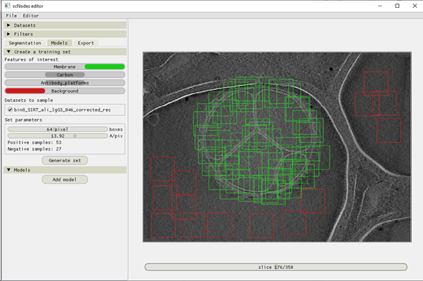 Creating a training dataset for a membrane-segmenting model