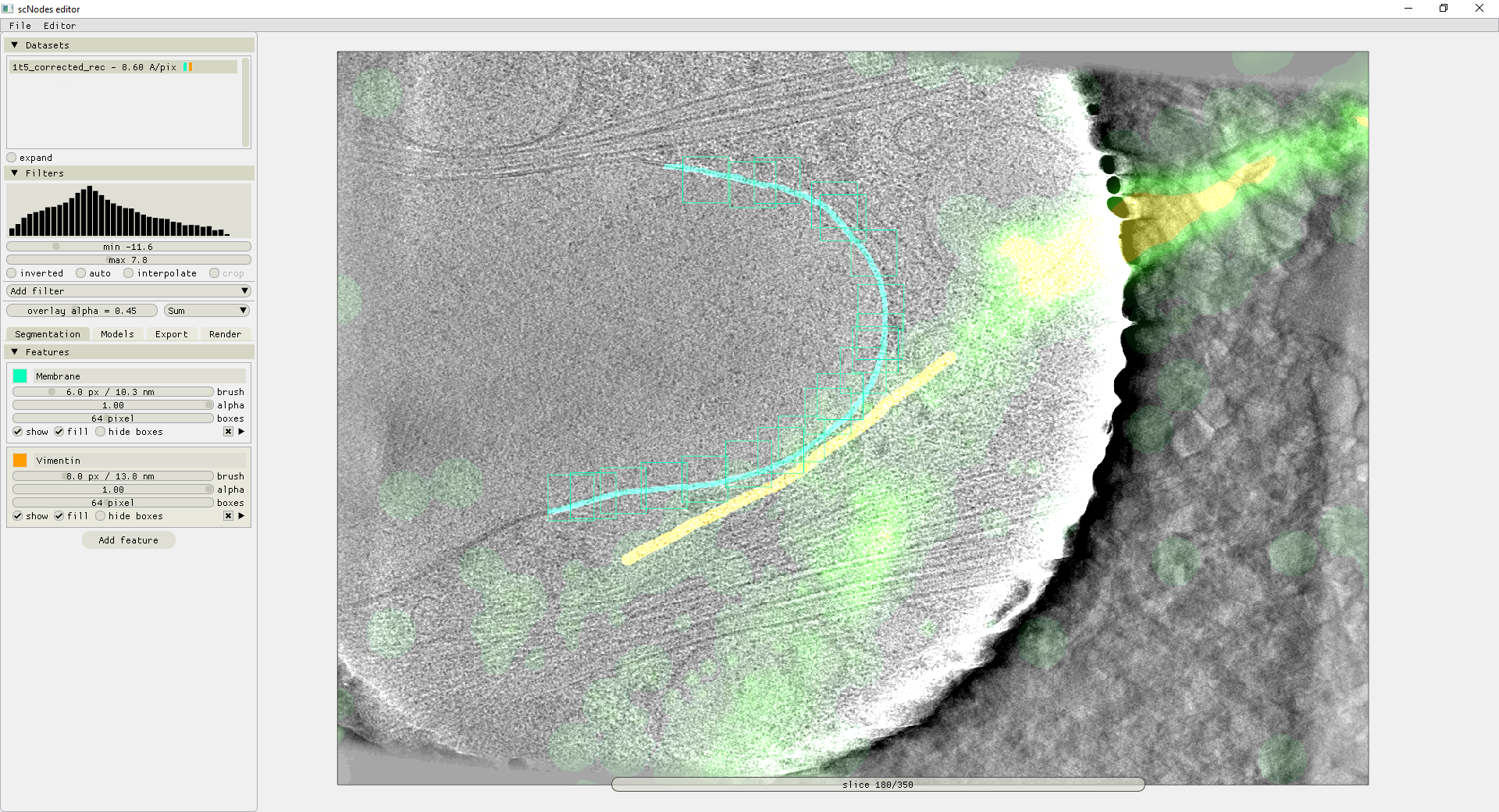 An example of scNodes+Ais segmenting a correlated fluorescence and cryoET dataset